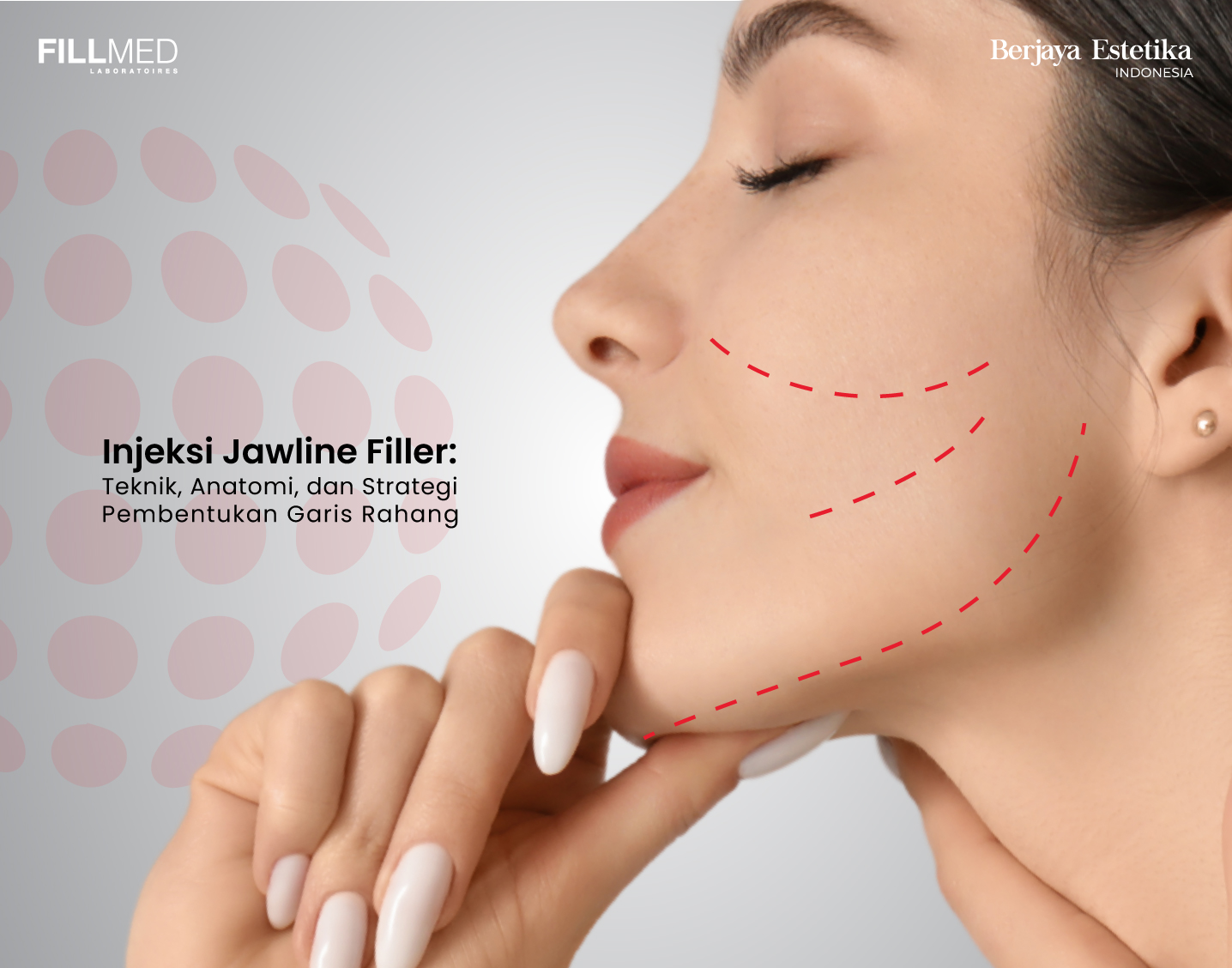 Jawline Filler