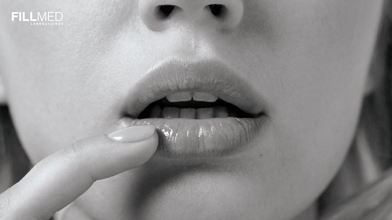 filler bibir
