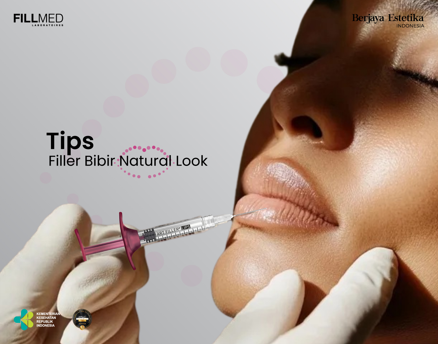 Filler Bibir Natural